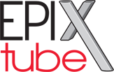 Epix Tube